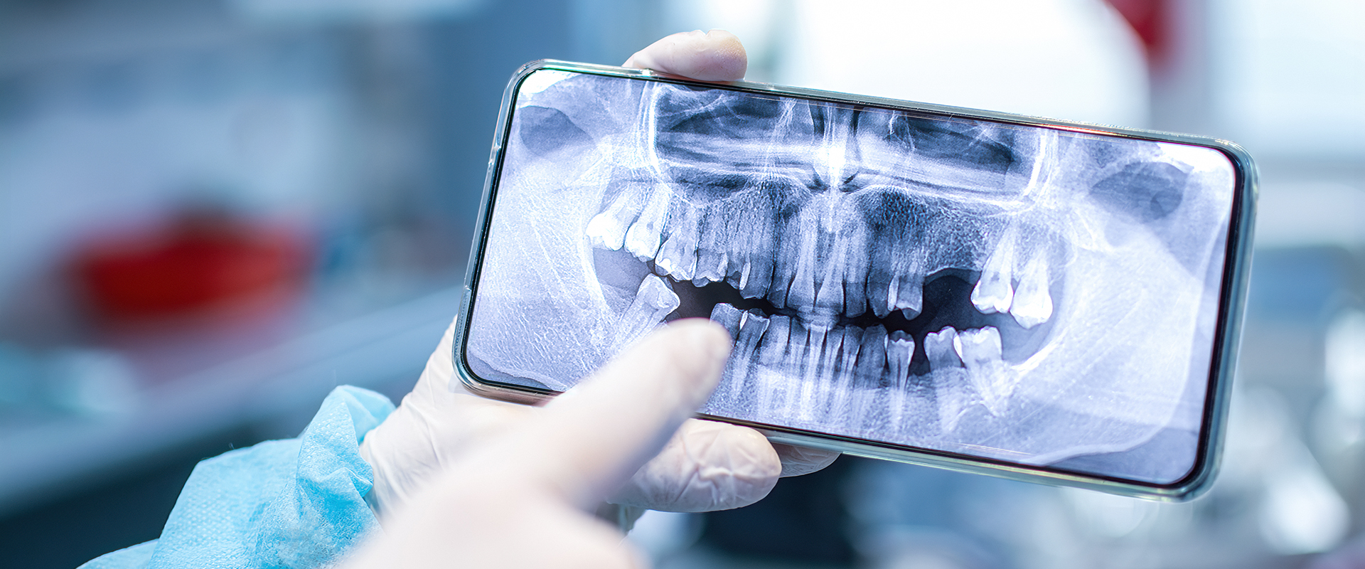 Digital Smile Designing 